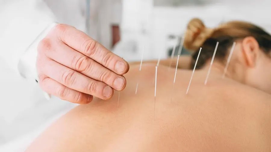 Kalrav Natural Cure - Special Therapies - Acupuncture